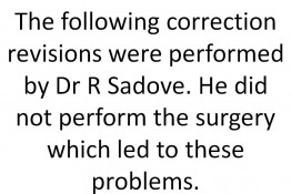 Correction of Implant Problems Performed by Another Surgeon Surgery