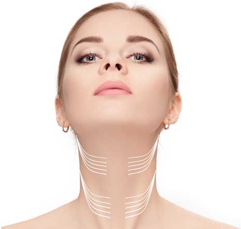 neck-lift