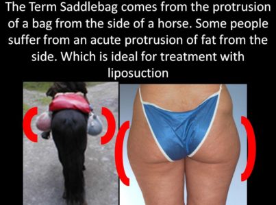 saddlebag