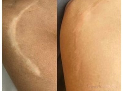 Camouflage Tattoo